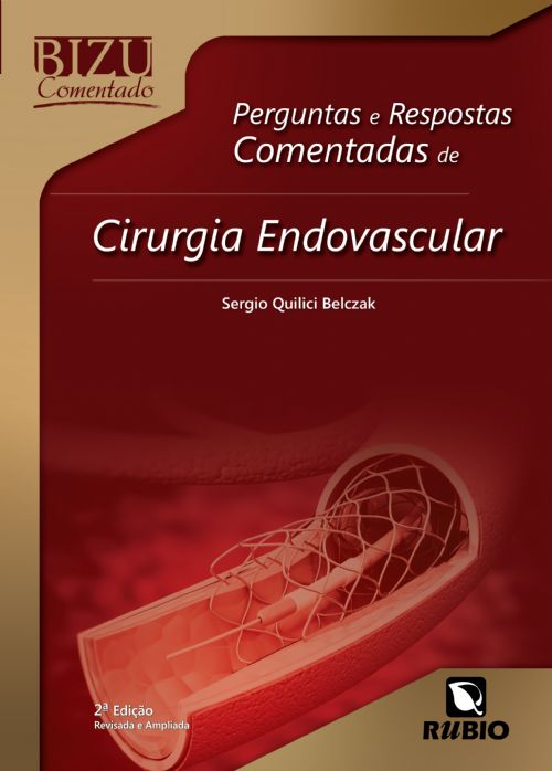Bizu Comentado - Perguntas E Respostas Comentadas De Cirurgia Endovascular - 2ª Edição
