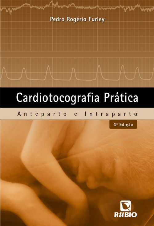 Cardiotocografia Prática - Anteparto E Intraparto