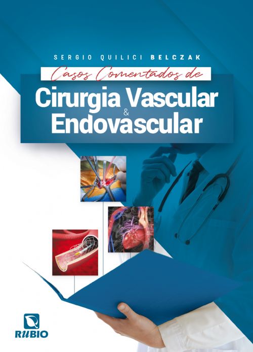 Casos Comentados de Cirurgia Vascular e Endovascular