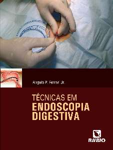Técnicas em Endoscopia Digestiva