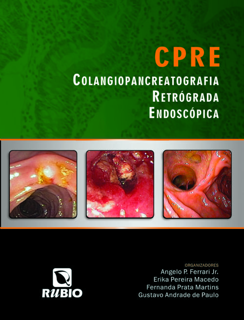 CPRE - Colangiopancreatografia Retrógrada Endoscópica
